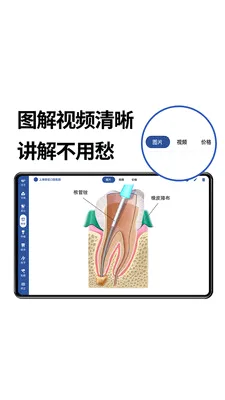 一分钟报价(口腔报价软件)截图